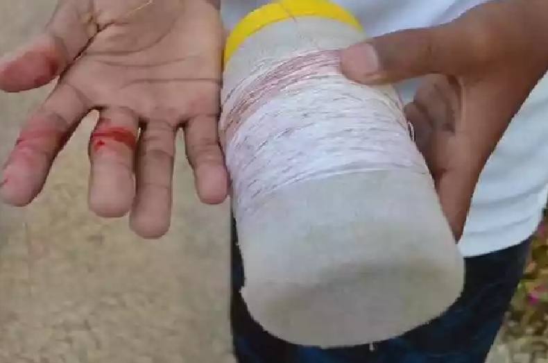 Motociclista tem pescoço cortado após ser atingido por linha chilena em Aparecida