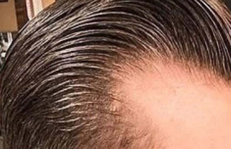Pomada modeladora de cabelo leva mais de 100 para o hospital no Rio